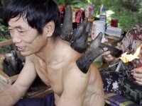 Двадцать нелепых способов лечения Ужасы народной медицины